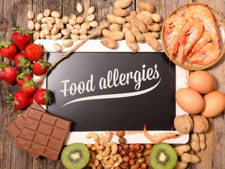 food allergies